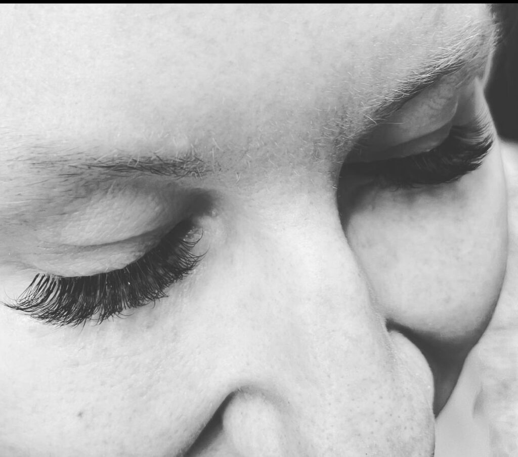 Eye treatments Portslade